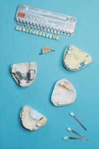 onetwothreedental_The Benefits of Dental Implant Treatment
