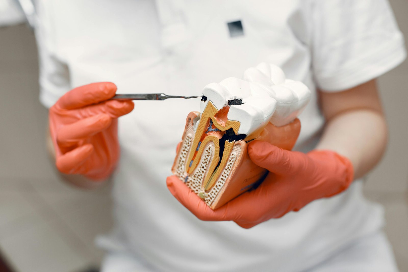 Choose a Trusted Clinic for Root Canal Treatment in Your Area