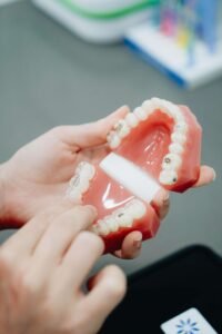 Braces vs. Aligners in Everyday Life: