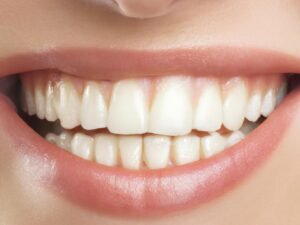Natural Teeth Whitening - Myths vs Facts | Guiseley Dentist