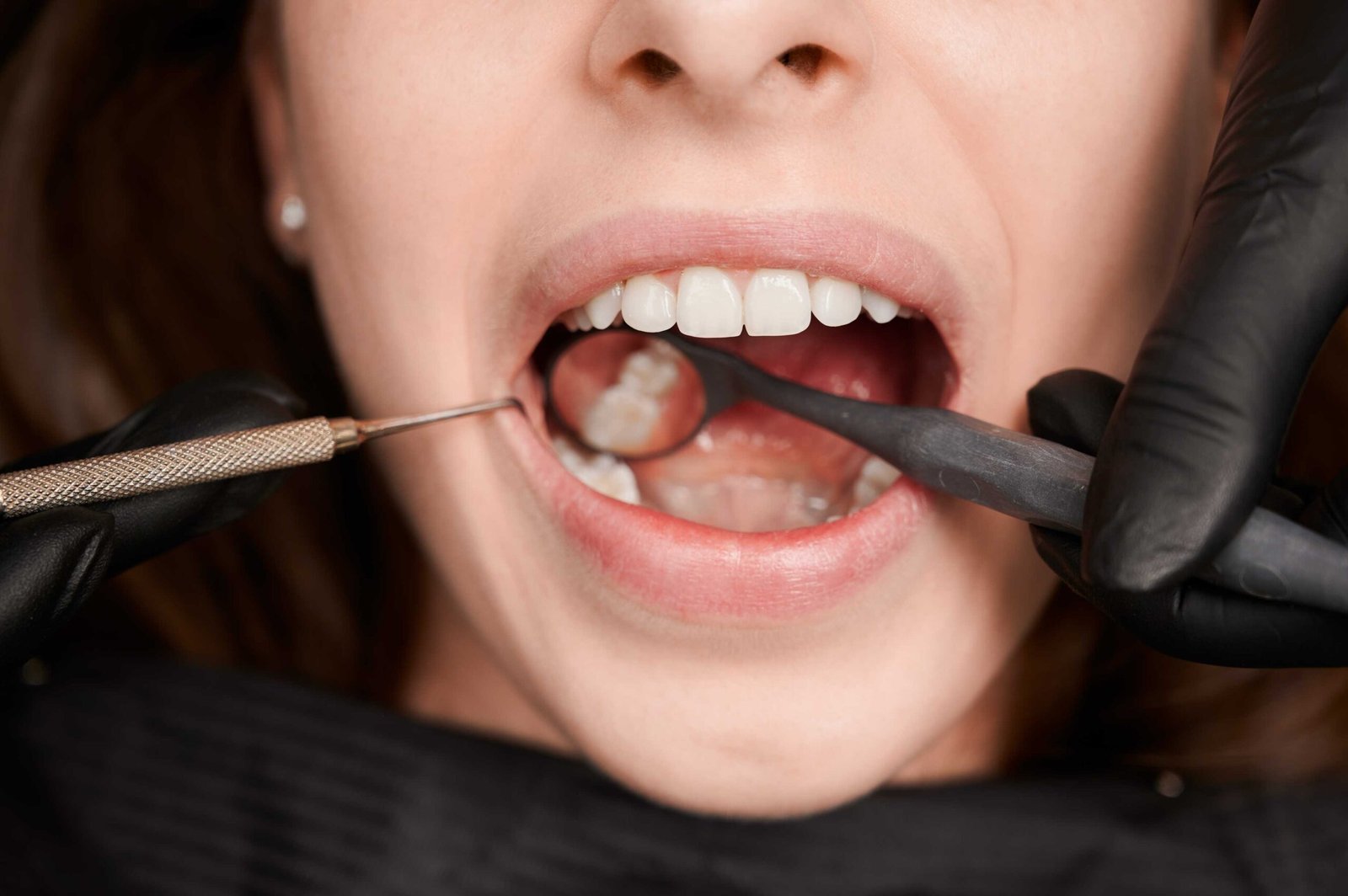How Often Should You Get an Airflow Stain Removal Treatment?