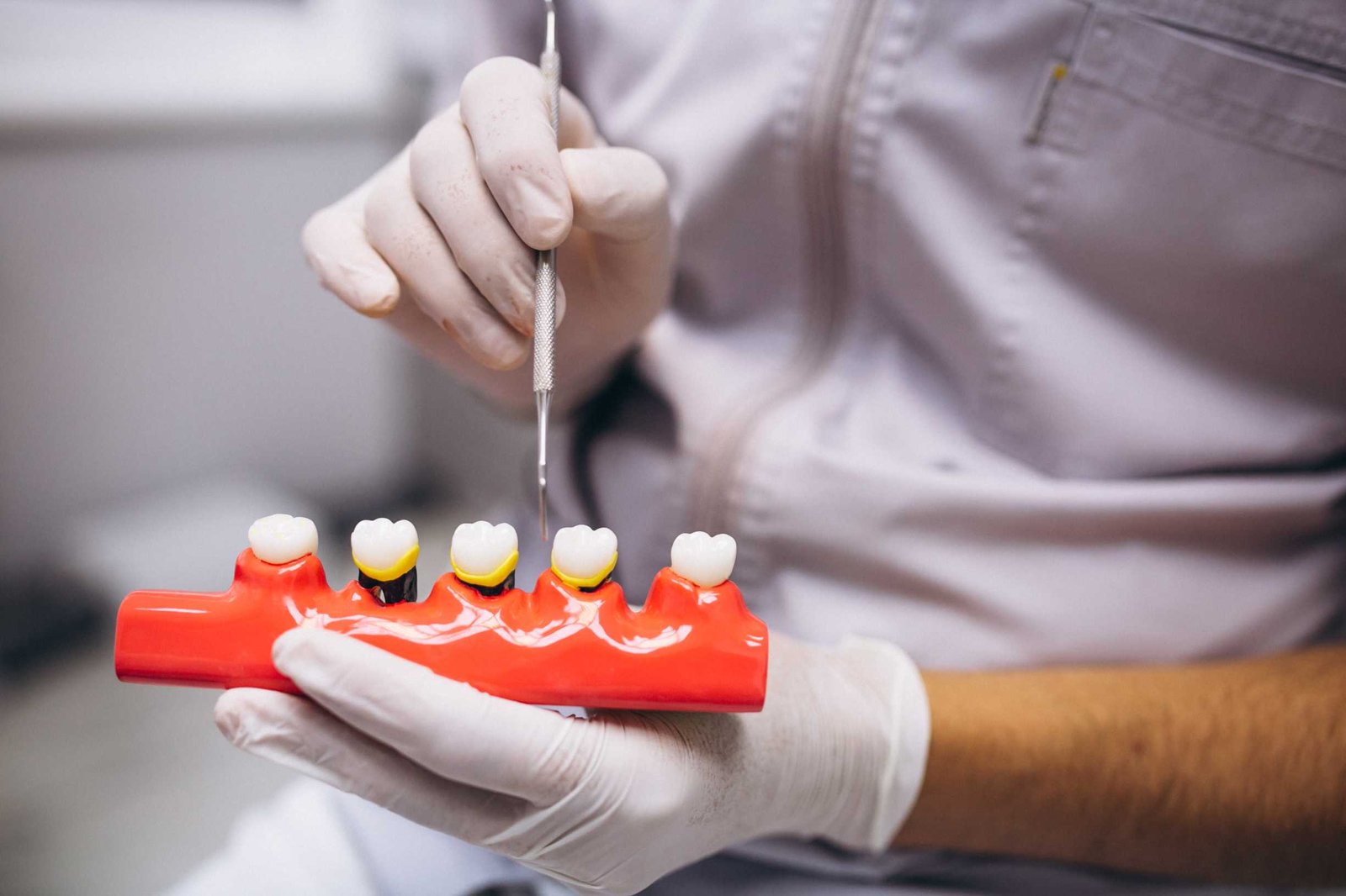 Why Dental Bridges Are the Ideal Solution for Missing Teeth?